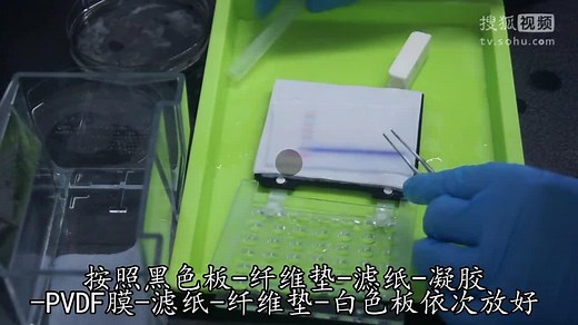 免疫印迹（Western Blot）实验操作指导