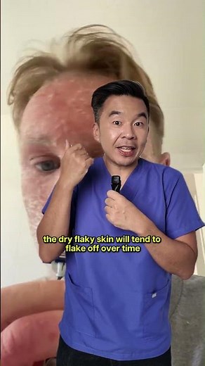 Eczema + Topical Steroid Withdrawal: What to Do