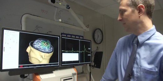Univ. of Iowa Health Care looks into how transcranial magnetic stimulation impacts the brain