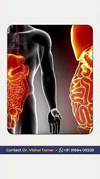 What to Eat After Hernia Surgery for a SMOOTH Recovery