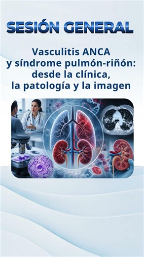 Vasculitis ANCA y síndrome pulmón-riñón: decisiones críticas desde la clínica.