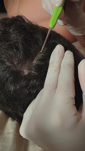 Asmr aplicado #asmr #asmrsounds #asmraplicado #asmrvideo | ASMR