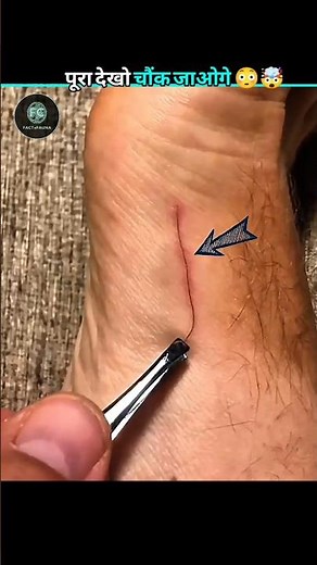 Hair Splinter? How Hair Goes Inside Your Skin 😱 #facts #amazingfacts #shortsfeed