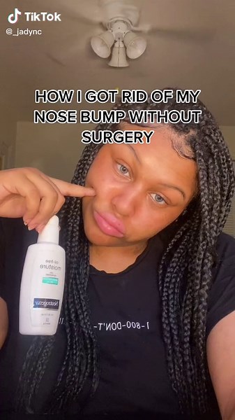 Effective Treatment for Painless Bumps on Nose