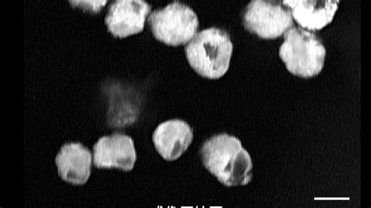 振电科技UltraView MK-III成像系统 SRS 模式白血病细胞物质拆分