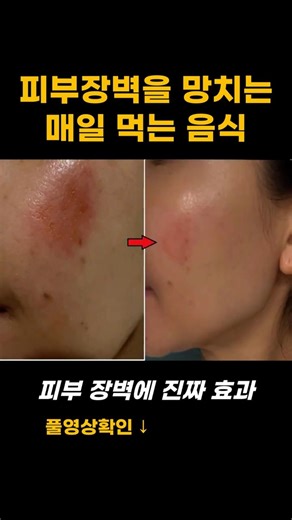 피부장벽이 매일 먹는 이것때문에 탄력이 떨어지고 굳어가고 있습니다