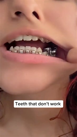 The miswak is such a great tool