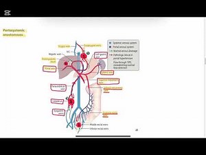 Portosystemic Anastomoses| First Aid book| NRE-1 / USMLE Step 1|part13
