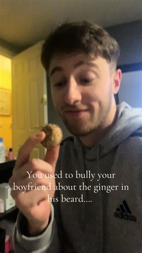 Celebrating the Love of Red Hair: A Funny Ginger Family Story