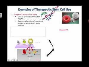 Therapeutic Stem Cell Uses (2016) IB Biology