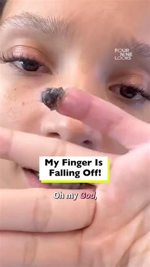 My finger is falling off and I don't know what to do 😭 | Four Nine Salon