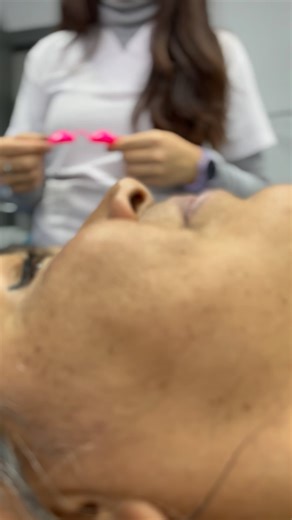 Conoce a Coolite Evo 🥼 Con este tratamiento podrás realizarte un rejuvenecimiento facial efectivo y rápido 😌 Pregunta por nuestras promociones en este tratamiento 💁 #skincare #saludybelleza #laserdespigmentador #rejuvenecimiento | ALTA Especialidad Medica