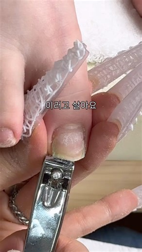 부서져 살수가 없어 #발톱연장#아크릴연장#파고드는발톱
