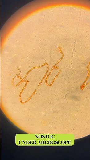 Nostoc under microscope || #nostoc #cyanobacteria #cyanophyta #algae #bacteria