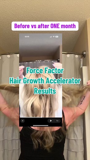 Before and after 1mo on @Force Factor hair accelerator chews 😵‍💫 #forcefactor #hairaccelerator #lustriva #hairgrowthjourney #Inverted