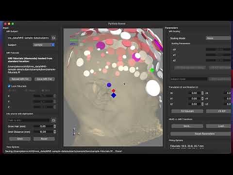 MNE-Python Tutorial on Coregistering EEG Digitization Points with an MRI