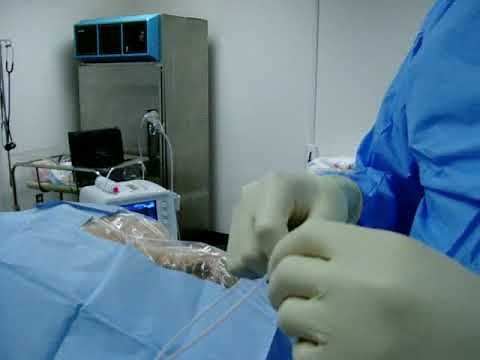 Central Line Placement