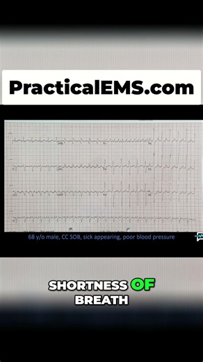 EKG Case: Unraveling Atrial Fibrillation & Heart Disease Secrets #shorts