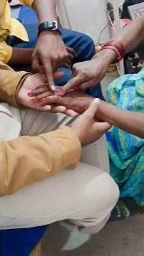 wrist & finger range of motion exercise #shortsviral