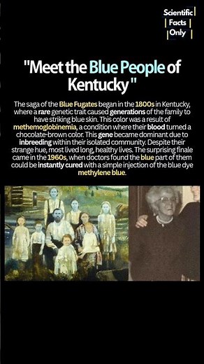 Why These People were Blue? 🤯#blood #science #didyouknow #shorts