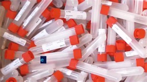Ahnenforschung - DNA-Herkunftsanalyse – wie sicher sind meine Daten?
