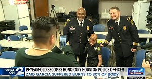 Inspiring Teen Who Suffered Severe Burns Becomes Honorary Police Officer | FaithPot