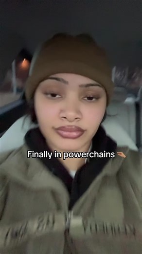 Braces and Powerchains: A Stylish Transformation