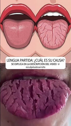 Lengua partida… 🙈⚠️