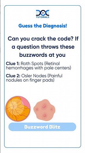 FMGE Prep:Roth Spots, Osler Nodes, and Janeway Lesions Explained!