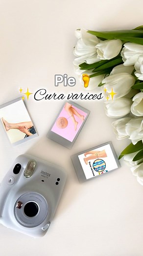 𝑨𝒏𝒈𝒊𝒆 ✨Escobar | Método eficaz 🦶por medio de tu pie elimina varices o arañitas en tu pierna 🦵. Ya sabías que puedes eliminar varices y arañitas con el... | Instagram