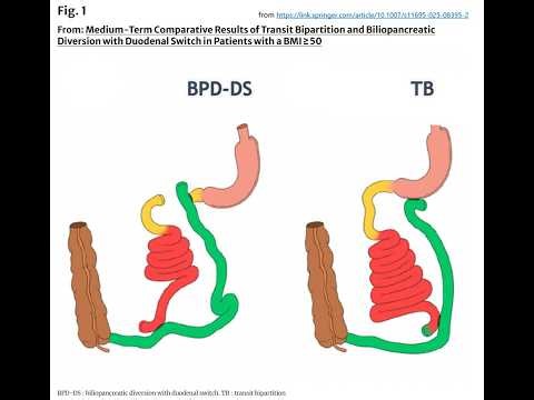 OBSU Brief Interview: Dr Oviedo interviews Dr Topart about this Top-10 February Article of Interest