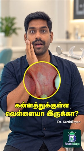 கன்னத்துக்குள்ள வெள்ளையா இருக்கா? - Leukoedema Explained | Dr. Karthikeyan | Denta Kings