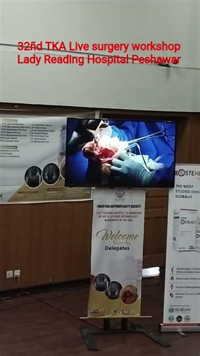 Removal of Osteophytes from Lateral tibial plateau in TOTAL KNEE ARTHROPLASTY.