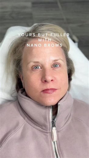 Microblading in Marietta | Atlanta | Georgia on Instagram: "😊Artist: Erin (Be Brows Team works are on the highlight tab) 🖊Technique: Nano Brows ⏱Duration time: 2 hours 💊Pre numb type: Cream 🖋Blade: 1RL 📏Thickness: Nano 💉Pain level: 1-2 (scale 1-10) ✨Last: 2-3 years 📍 1401 Johnson Ferry Rd Suite 124, Marietta GA 30062 💳Booking: $100 (non refundable/ non transferable) deposit will go toward the service. ☎️ Call/SMS: 404 944 3919 (Habla Espanol) 📖 Appointment: http://bebrows.us ⭐️For previ