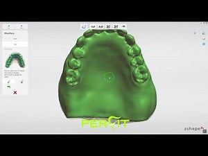 How to scan an existing denture with 3Shape scanner