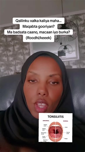 Exploring Somali Cuisine: Recipes for Delicious Dishes