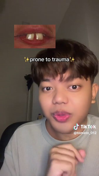 Understanding Overbites: Labubu's Dental Journey