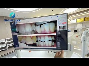 Dental Intraoral Camera Sytem 21.5-Inch Ultra-thin Bezel-less ALL-IN-ONE Computor