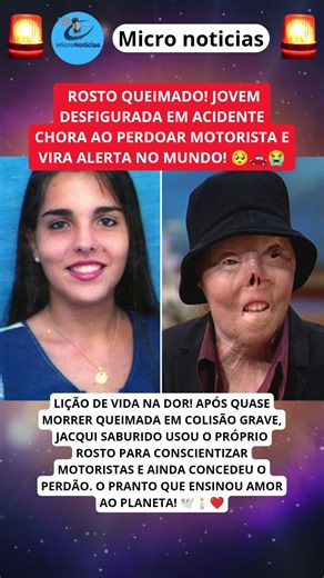 JACQUI SABURIDO chora ao transformar dor de acidente em lição