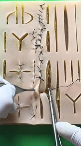 51K views · 253 reactions | Running buried dermal suture | Dermhacks | Facebook