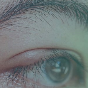 🔴 What are eyelash mites? . There are two types of Demodex mites called Demodex folliculorum and Demodex brevis that cause eyelash problems. Both kinds of these mites are so tiny, so they can’t be seen by naked eyes. They’re naturally common in your hair follicles, and they feed on dead skin cells. . D. folliculorum is the more common to affect eyelashes than D.brevis. . How Ungex can help? Ungex natural products help you treat all types of human follicle mites known as Demodex folliculorum and