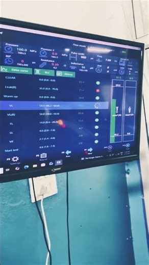 Delphi injector cheking