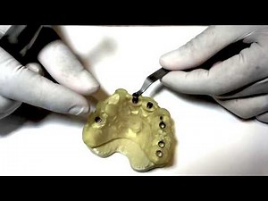 Kit Neodent Guided Surgery - Grand Morse