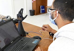 Tunisia, 3D printed bionic hand: grows as the amputee child grows