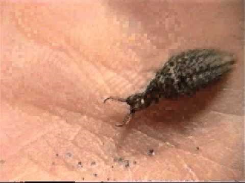 The Antlion Pit: Handling Antlions