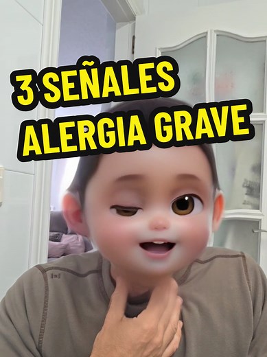 3 Señales de Alergia Grave