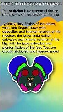 Super Quick Neuro: Flexor and Extensor Posturing #education #anatomyvideos #neuro #posturing
