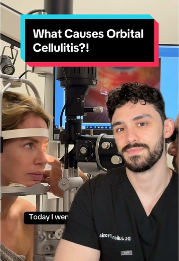 Understanding Orbital Cellulitis Causes and Risks