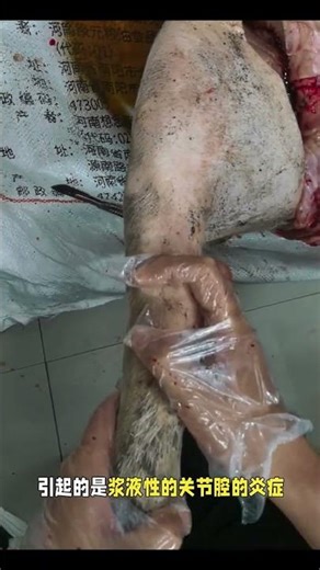 The identification of joint swelling Streptococcus initially presents as suppurative