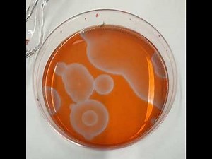 Belousov Zhabotinsky reaction